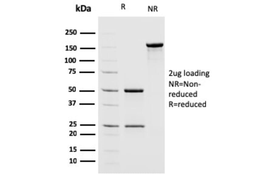 SDS-PAGE - Anti-MSH2 Antibody [MSH2/2622] - BSA and Azide free (A252561) - Antibodies.com