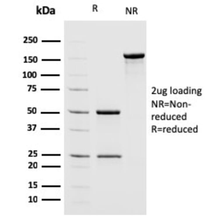 SDS-PAGE - Anti-MSH2 Antibody [MSH2/2622] - BSA and Azide free (A252561) - Antibodies.com