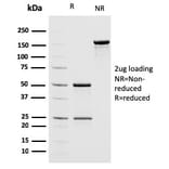 SDS-PAGE - Anti-MSH2 Antibody [MSH2/2622] - BSA and Azide free (A252561) - Antibodies.com