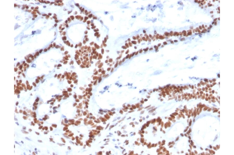Immunohistochemistry - Anti-MSH2 Antibody [MSH2/2622] - BSA and Azide free (A252561) - Antibodies.com