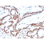 Immunohistochemistry - Anti-MSH2 Antibody [MSH2/2622] - BSA and Azide free (A252561) - Antibodies.com