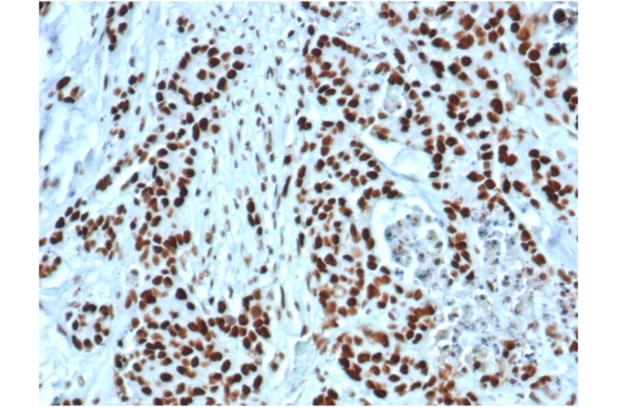 Immunohistochemistry - Anti-MSH2 Antibody [MSH2/6549R] - BSA and Azide free (A252562) - Antibodies.com