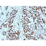 Immunohistochemistry - Anti-MSH2 Antibody [MSH2/6549R] - BSA and Azide free (A252562) - Antibodies.com