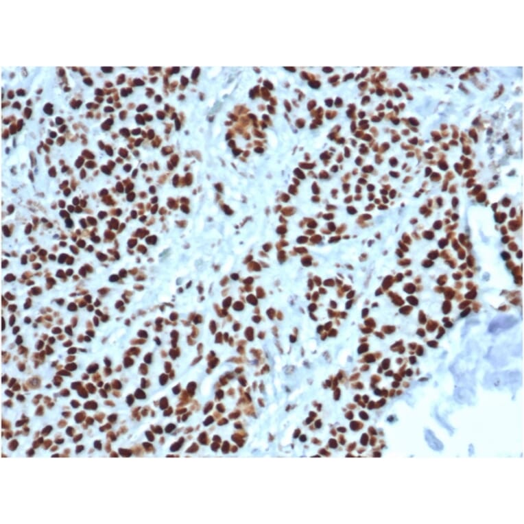 Immunohistochemistry - Anti-MSH2 Antibody [MSH2/6549R] - BSA and Azide free (A252561) - Antibodies.com
