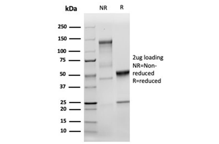 SDS-PAGE - Anti-MSH2 Antibody [MSH2/6549R] - BSA and Azide free (A252562) - Antibodies.com