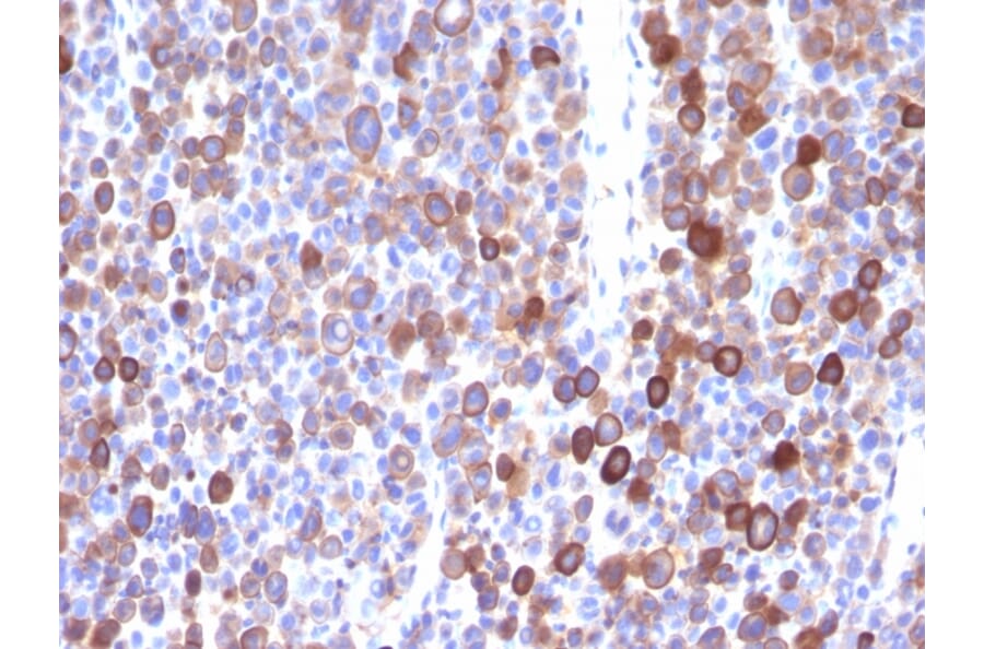 Immunohistochemistry - Anti-Moesin Antibody [MSN/491] - BSA and Azide free (A252563) - Antibodies.com