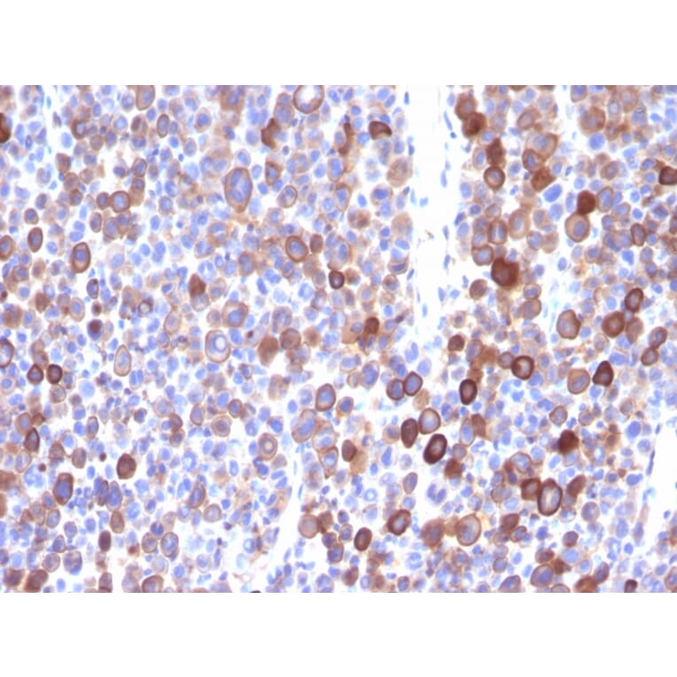 Immunohistochemistry - Anti-Moesin Antibody [MSN/491] - BSA and Azide free (A252563) - Antibodies.com