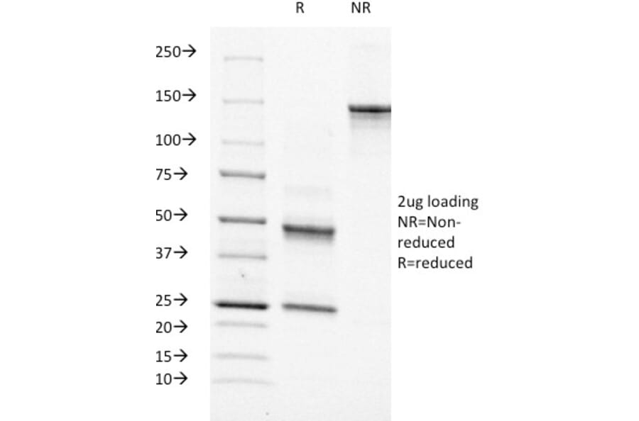 SDS-PAGE - Anti-Moesin Antibody [MSN/491] - BSA and Azide free (A252563) - Antibodies.com