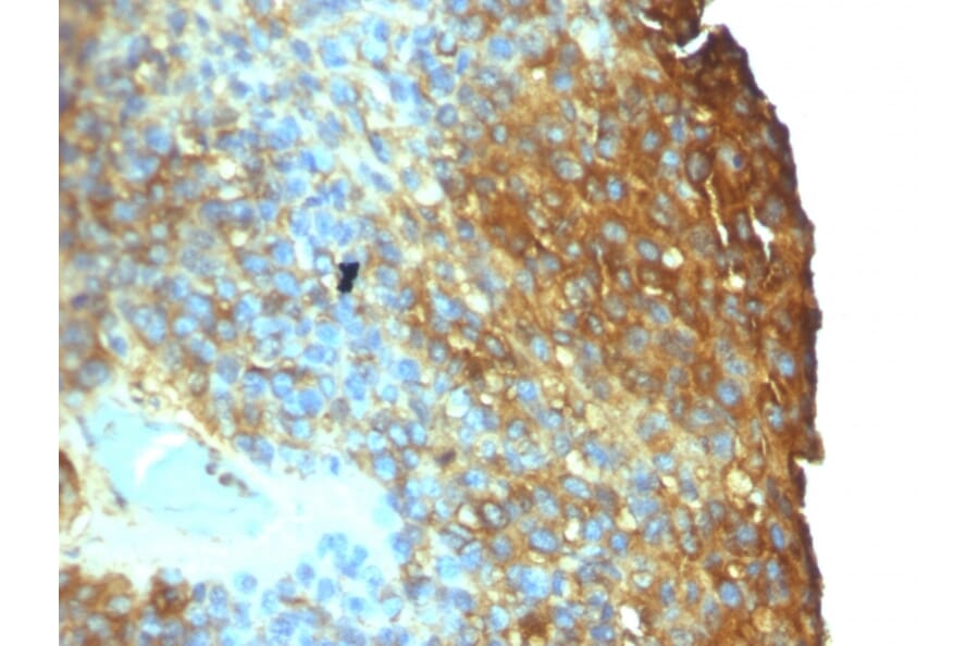Immunohistochemistry - Anti-Moesin Antibody [SPM562] - BSA and Azide free (A252564) - Antibodies.com