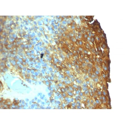Immunohistochemistry - Anti-Moesin Antibody [SPM562] - BSA and Azide free (A252564) - Antibodies.com