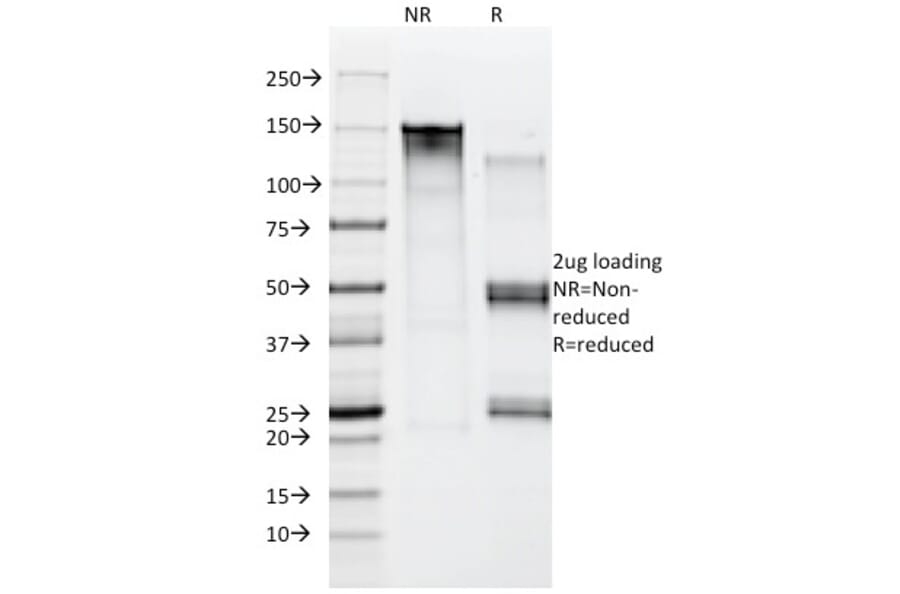 SDS-PAGE - Anti-Moesin Antibody [MSN/492] - BSA and Azide free (A252565) - Antibodies.com