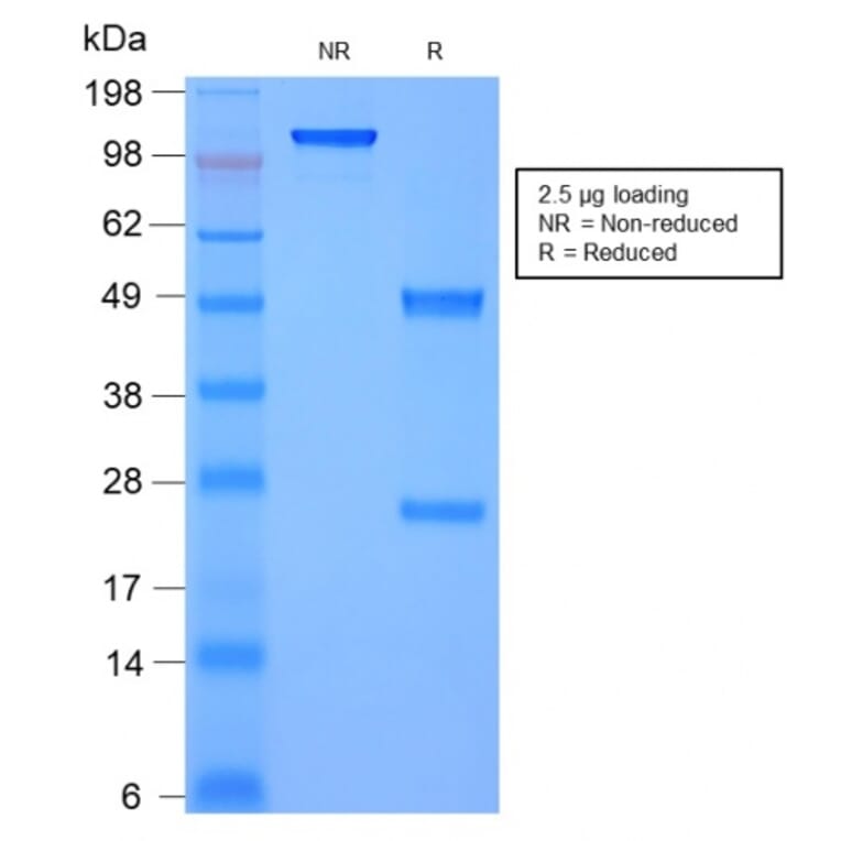 SDS-PAGE - Anti-Moesin Antibody [rMSN/492] - BSA and Azide free (A252567) - Antibodies.com