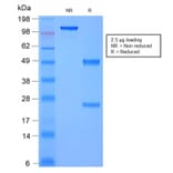 SDS-PAGE - Anti-Moesin Antibody [rMSN/492] - BSA and Azide free (A252567) - Antibodies.com