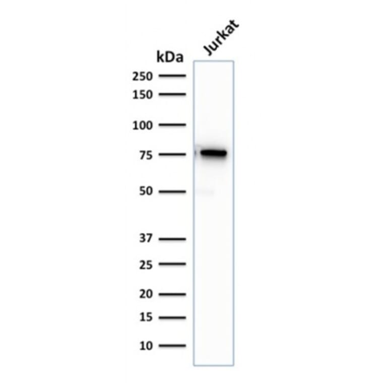 Western Blot - Anti-Moesin Antibody [rMSN/492] - BSA and Azide free (A252567) - Antibodies.com