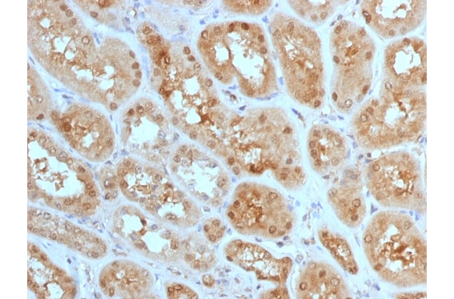 Immunohistochemistry - Anti-MTAP Antibody [MTAP/1813] - BSA and Azide free (A252568) - Antibodies.com