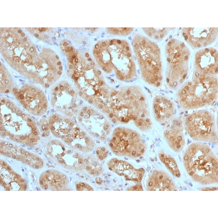 Immunohistochemistry - Anti-MTAP Antibody [MTAP/1813] - BSA and Azide free (A252568) - Antibodies.com