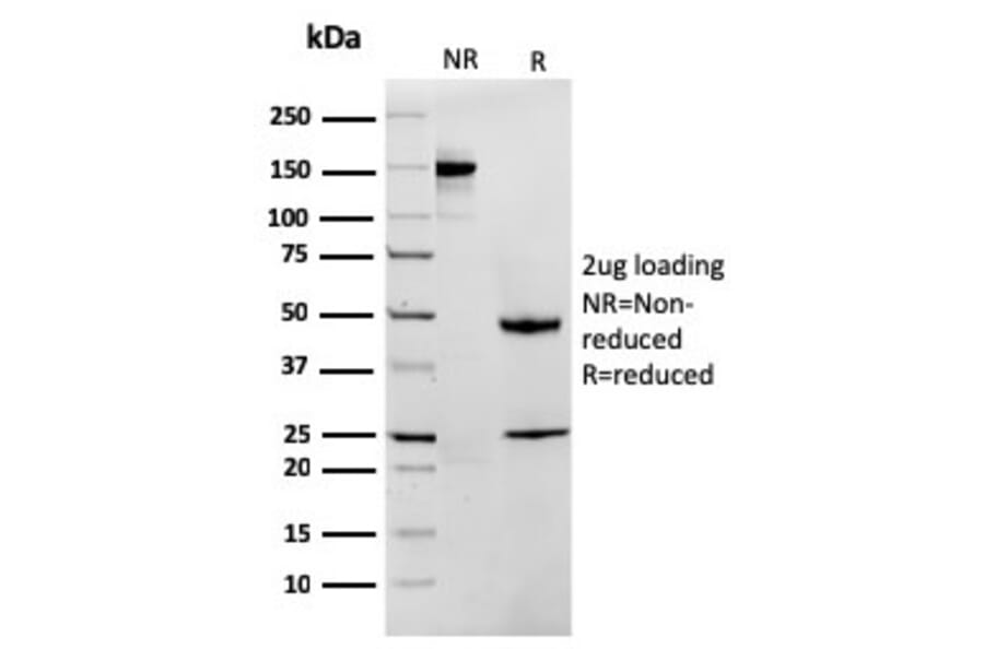 SDS-PAGE - Anti-MTAP Antibody [MTAP/1813] - BSA and Azide free (A252568) - Antibodies.com
