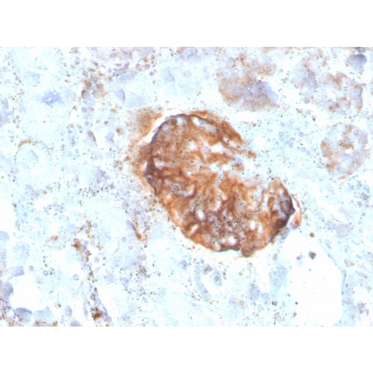 Immunohistochemistry - Anti-MTAP Antibody [rMTAP/1813] - BSA and Azide free (A252569) - Antibodies.com
