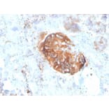 Immunohistochemistry - Anti-MTAP Antibody [rMTAP/1813] - BSA and Azide free (A252569) - Antibodies.com