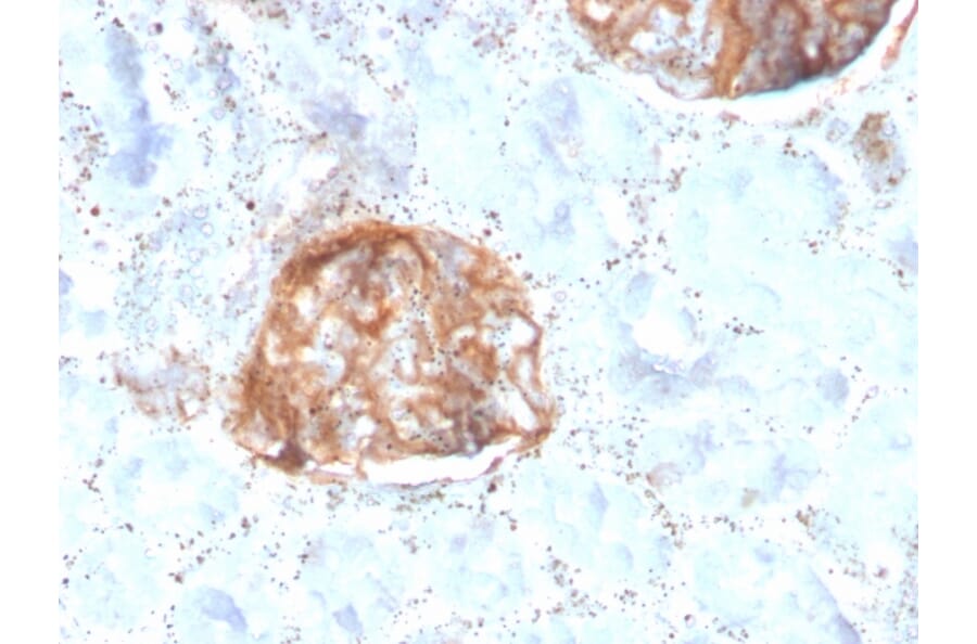 Immunohistochemistry - Anti-MTAP Antibody [rMTAP/1813] - BSA and Azide free (A252568) - Antibodies.com