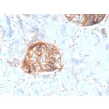 Immunohistochemistry - Anti-MTAP Antibody [rMTAP/1813] - BSA and Azide free (A252568) - Antibodies.com