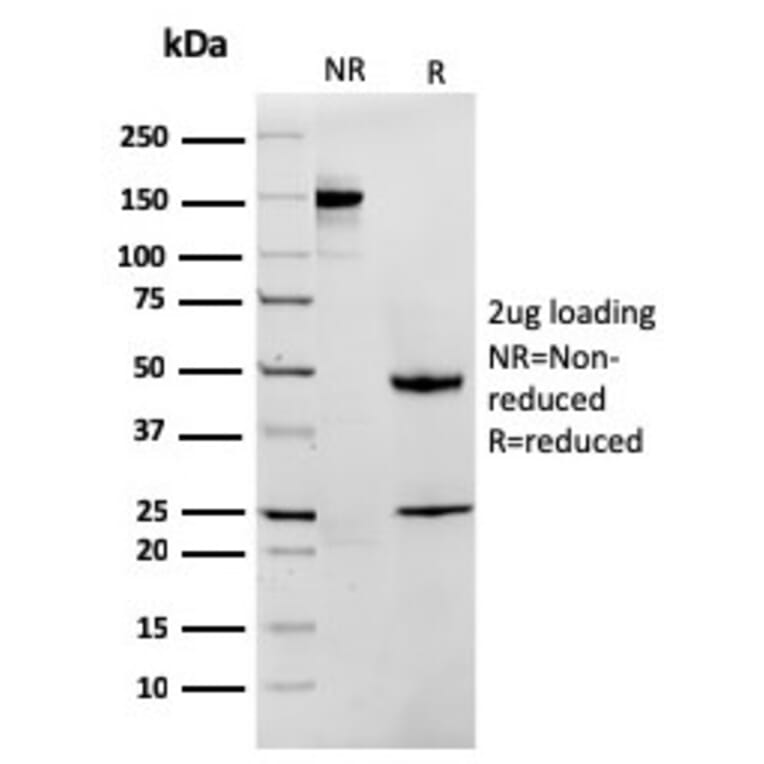 SDS-PAGE - Anti-MTAP Antibody [rMTAP/1813] - BSA and Azide free (A252569) - Antibodies.com