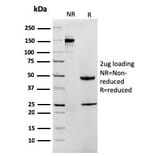 SDS-PAGE - Anti-MTAP Antibody [rMTAP/1813] - BSA and Azide free (A252569) - Antibodies.com