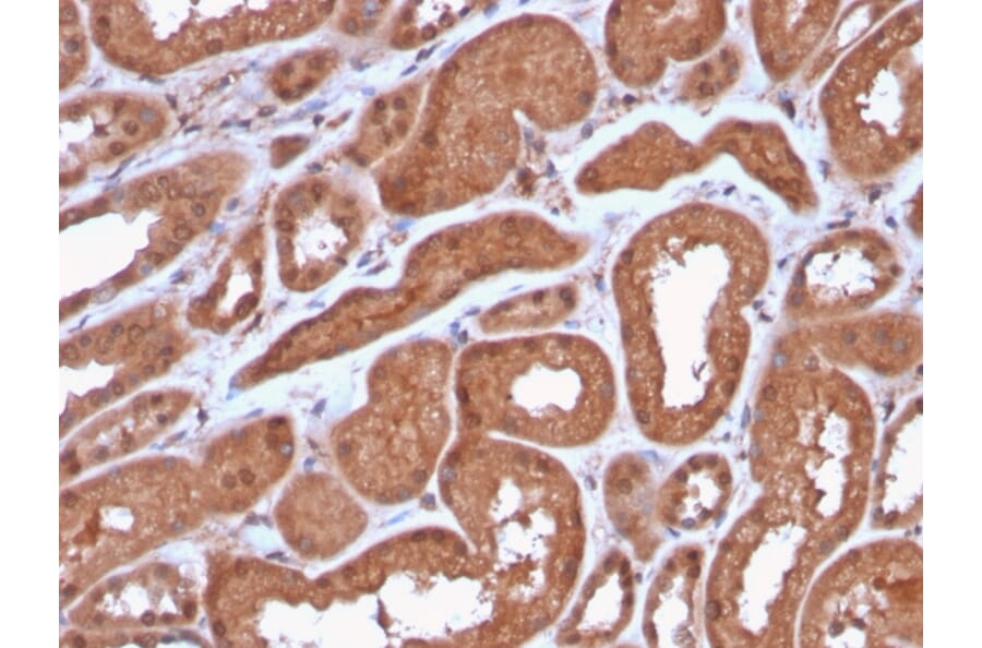 Immunohistochemistry - Anti-MTAP Antibody [MTAP/3137R] - BSA and Azide free (A252570) - Antibodies.com