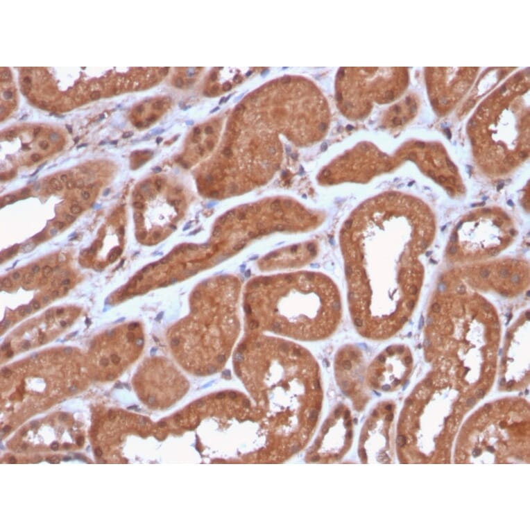 Immunohistochemistry - Anti-MTAP Antibody [MTAP/3137R] - BSA and Azide free (A252570) - Antibodies.com