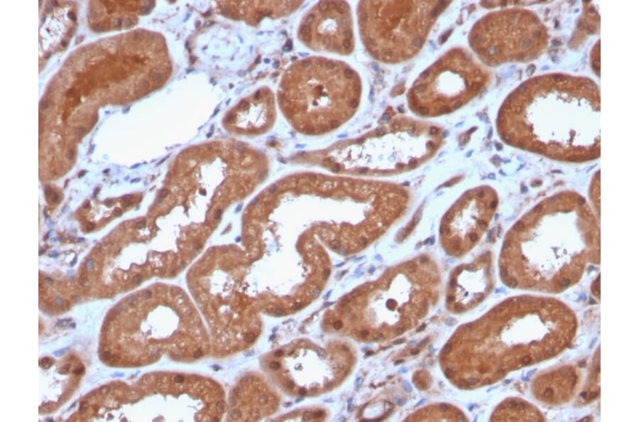 Immunohistochemistry - Anti-MTAP Antibody [MTAP/3137R] - BSA and Azide free (A252569) - Antibodies.com