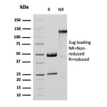 SDS-PAGE - Anti-MTAP Antibody [MTAP/3137R] - BSA and Azide free (A252570) - Antibodies.com
