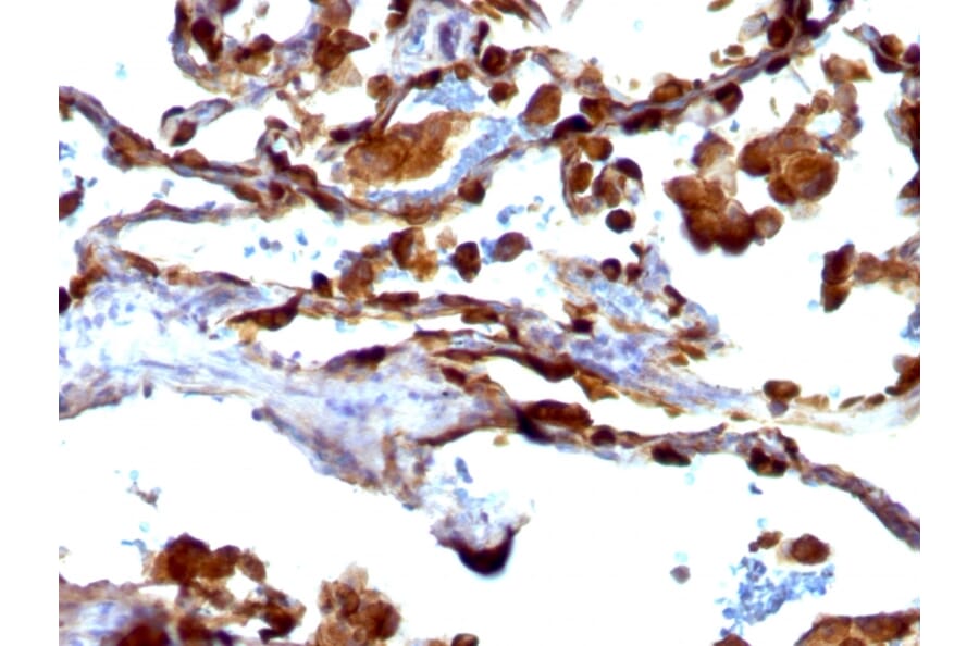 Immunohistochemistry - Anti-MUC1 Antibody [VU-4H5] - BSA and Azide free (A252573) - Antibodies.com