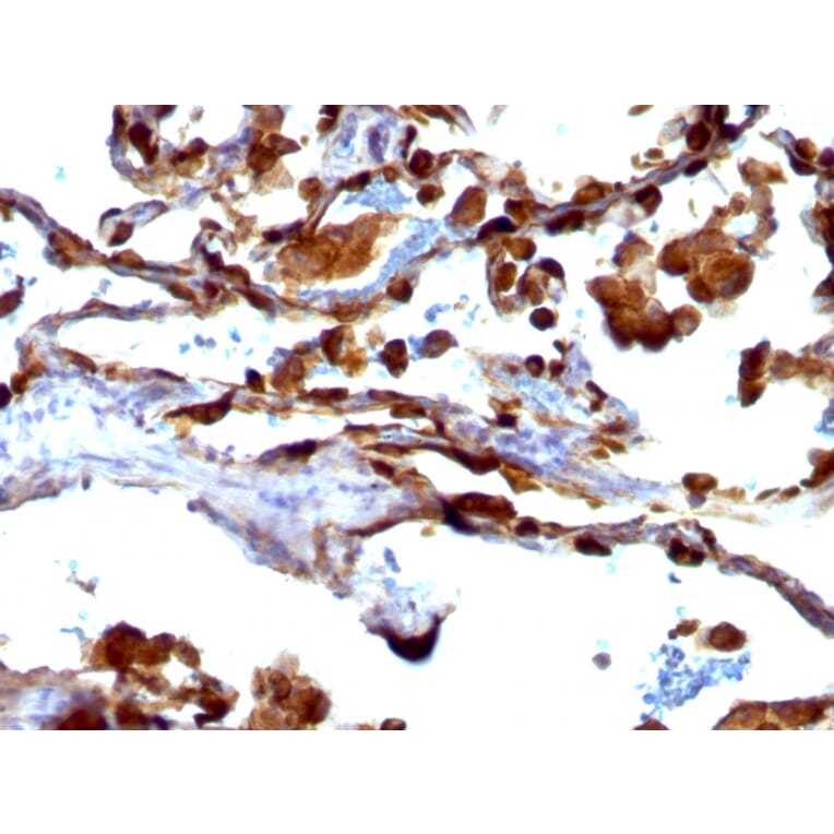 Immunohistochemistry - Anti-MUC1 Antibody [VU-4H5] - BSA and Azide free (A252573) - Antibodies.com