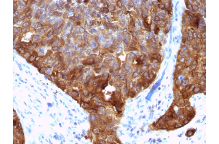 Immunohistochemistry - Anti-MUC1 Antibody [VU-4H5] - BSA and Azide free (A252572) - Antibodies.com