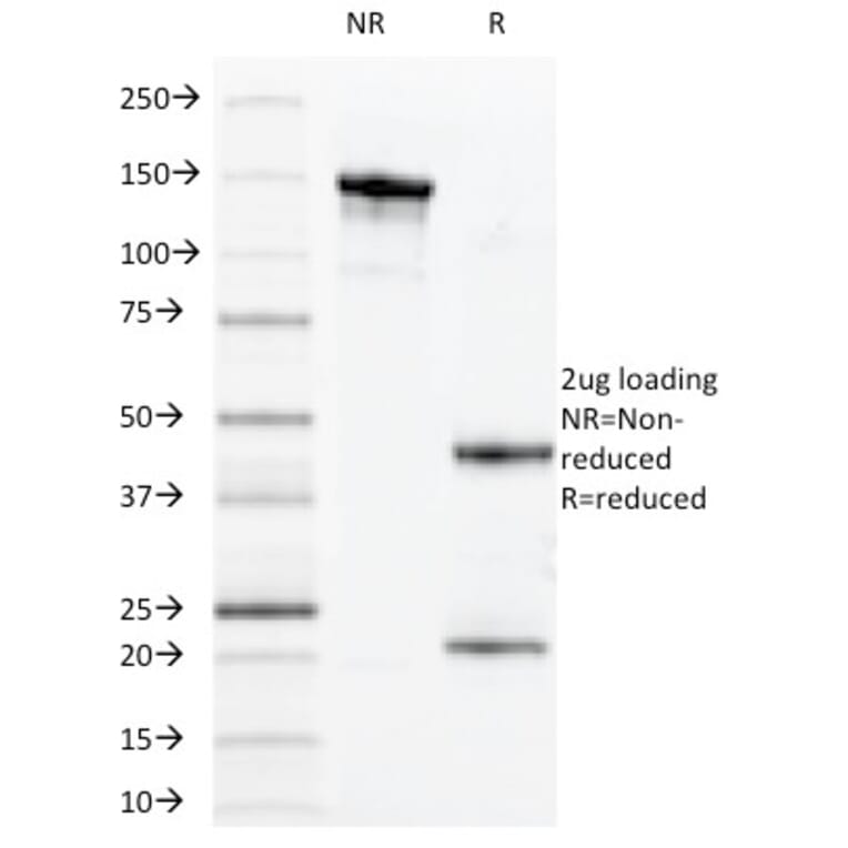 SDS-PAGE - Anti-MUC1 Antibody [VU-11D1] - BSA and Azide free (A249394) - Antibodies.com