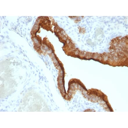 Immunohistochemistry - Anti-MUC1 Antibody [HMPV] - BSA and Azide free (A252575) - Antibodies.com