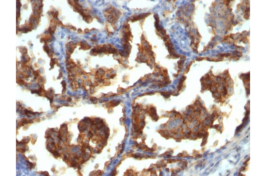 Immunohistochemistry - Anti-MUC1 Antibody [MUC1/955] - BSA and Azide free (A252576) - Antibodies.com