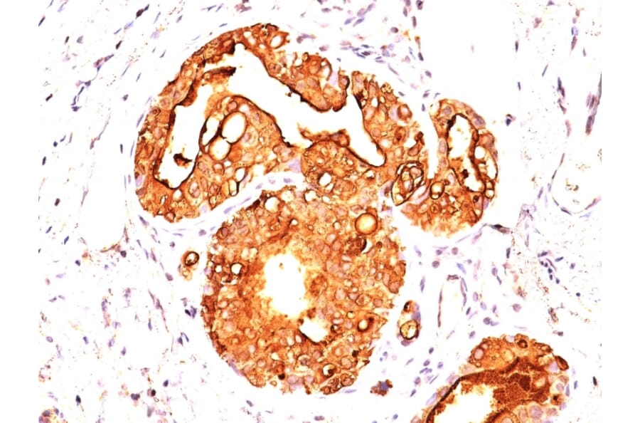 Immunohistochemistry - Anti-MUC1 Antibody [MUC1/955] - BSA and Azide free (A252575) - Antibodies.com