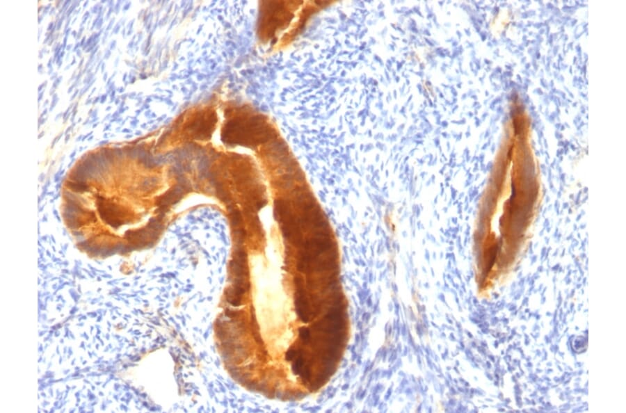 Immunohistochemistry - Anti-MUC1 Antibody [MUC1/955] - BSA and Azide free (A252576) - Antibodies.com