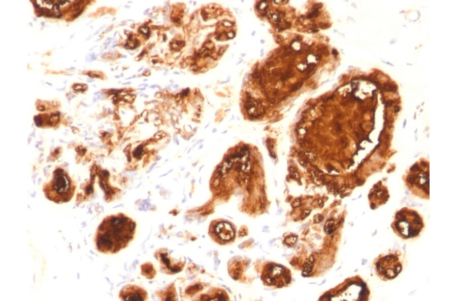 Immunohistochemistry - Anti-MUC1 Antibody [rMUC1/960] - BSA and Azide free (A252576) - Antibodies.com