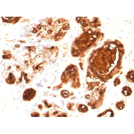 Immunohistochemistry - Anti-MUC1 Antibody [rMUC1/960] - BSA and Azide free (A252576) - Antibodies.com