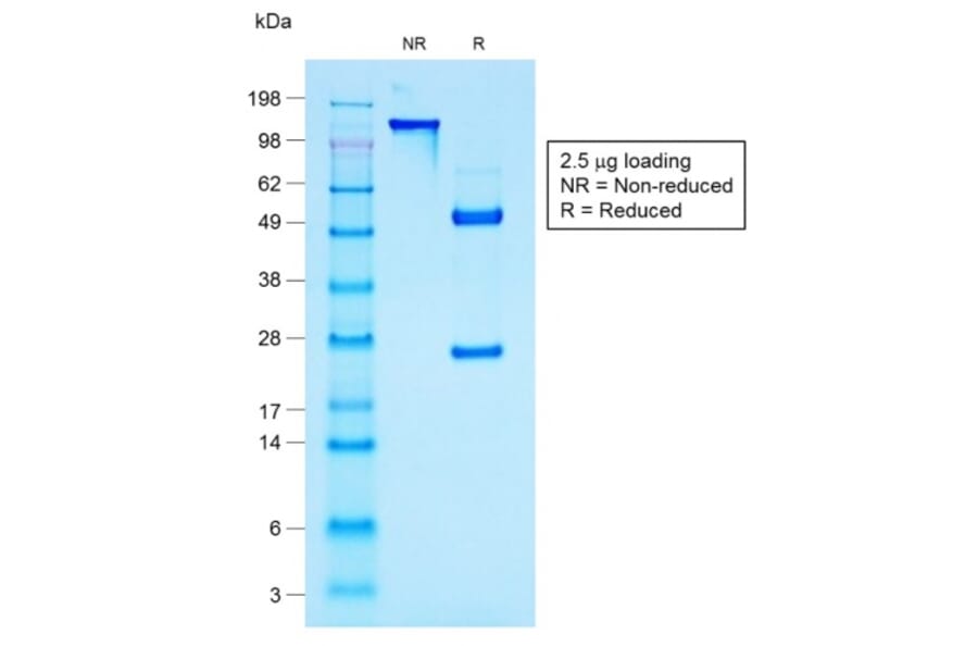 SDS-PAGE - Anti-MUC1 Antibody [rMUC1/960] - BSA and Azide free (A252577) - Antibodies.com