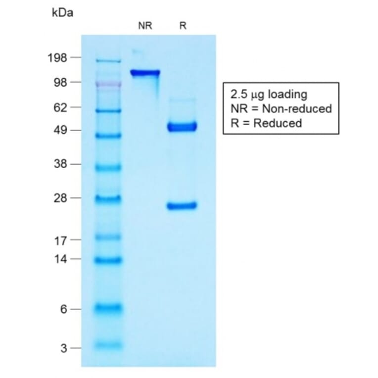 SDS-PAGE - Anti-MUC1 Antibody [rMUC1/960] - BSA and Azide free (A252577) - Antibodies.com