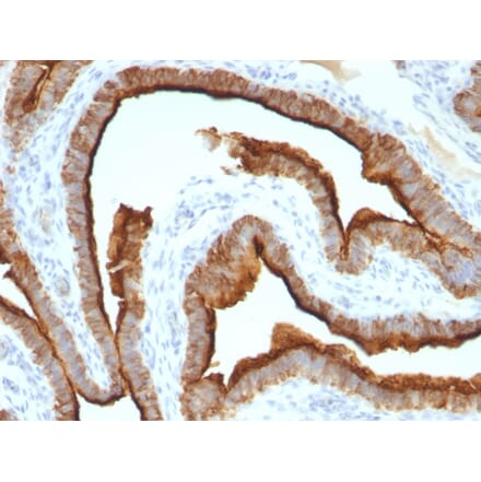 Immunohistochemistry - Anti-MUC1 Antibody [MUC1/967] - BSA and Azide free (A252578) - Antibodies.com