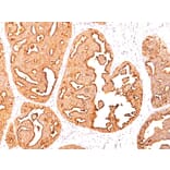 Immunohistochemistry - Anti-MUC1 Antibody [MUC1/967] - BSA and Azide free (A252577) - Antibodies.com