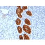 Immunohistochemistry - Anti-MUC1 Antibody [MUC1/967] - BSA and Azide free (A252578) - Antibodies.com