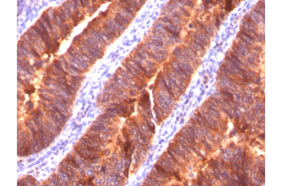 Immunohistochemistry - Anti-MUC1 Antibody [MUC1/520] - BSA and Azide free (A252579) - Antibodies.com