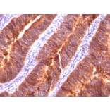 Immunohistochemistry - Anti-MUC1 Antibody [MUC1/520] - BSA and Azide free (A252579) - Antibodies.com
