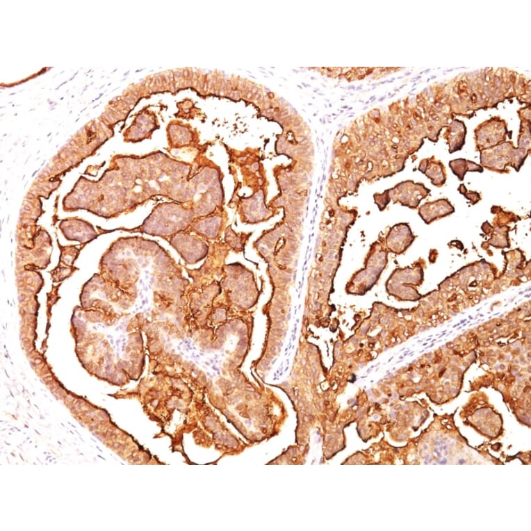 Immunohistochemistry - Anti-MUC1 Antibody [MUC1/520] - BSA and Azide free (A252579) - Antibodies.com