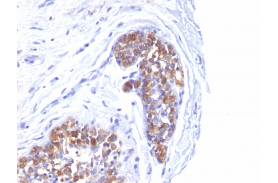 Immunohistochemistry - Anti-MUC1 Antibody [MUC1/520] - BSA and Azide free (A252579) - Antibodies.com